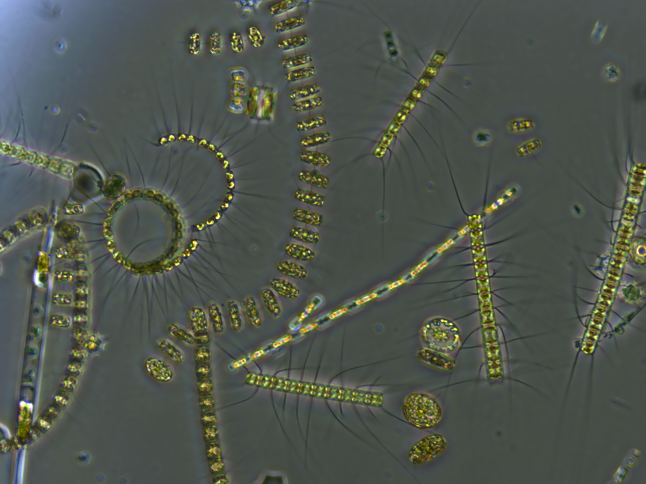 Phytoplancton vu de proche